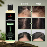 Rosemary Hydrolyzed Keratin Shampoo 100 ml Pack of 1
